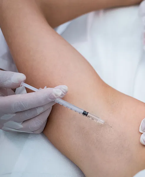Aplicación de toxina botulínica para hiperhidrosis en axila realizada en clínica dermatológica en CDMX