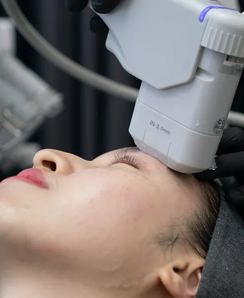 Tratamiento HIFU Booster realizado en clínica dermatológica en CDMX