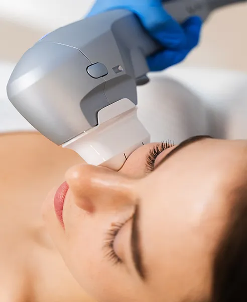 Tratamiento HIFU facial realizado en clínica dermatológica en CDMX