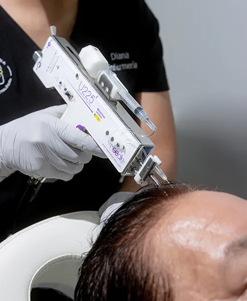 Requiere mantenimiento. Si se suspende el tratamiento, la alopecia puede continuar su evolución natural.