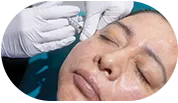 Aplicación de botox e inyectables faciales en clínica dermatológica en CDMX