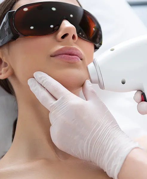 Tratamiento de depilación facial láser en Porcelana Clínica Dermatológica CDMX para eliminación de vello no deseado
